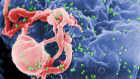 A scanning electron micrograph of multiple round bumps of the HIV-1 virus on a cell’s surface.