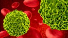 Blood cancers, including leukaemia and lymphoma, are now the second most common and deadly form of cancer, according to the Leukaemia Foundation.