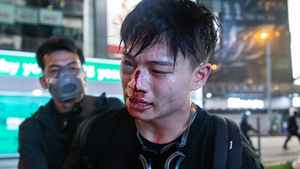 An injured demonstrator is detained by a man believed to be a police officer dressed as a protester on Sunday.
