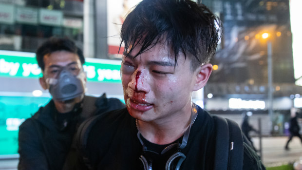 An injured demonstrator is detained by a man believed to be a police officer dressed as a protester on Sunday.