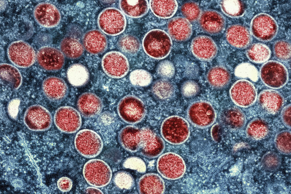 A colourised transmission electron micrograph of mpox particles, which are red.