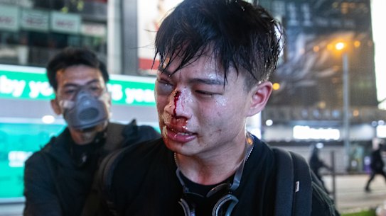 An injured demonstrator is detained by a man believed to be a police officer dressed as a protester on Sunday.