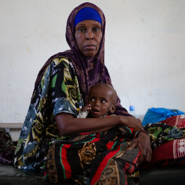 Farhan Apti, Somaliland'daki Burao General Hospital'da büyükannesi Arfi Jama tarafından emziriliyor.  17 aylık bebek yetersiz beslenme nedeniyle tedavi altına alındı.