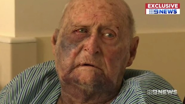 The victim of a brutal home invasion and bashing in a Childers home, 90-year-old Doug Dilger, as he recovers in hospital.