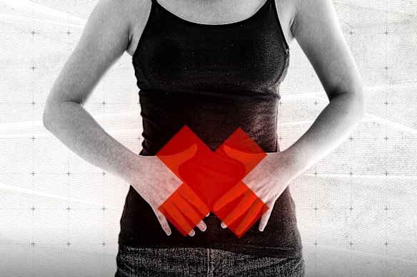 Women are increasingly getting surgery for endometriosis.