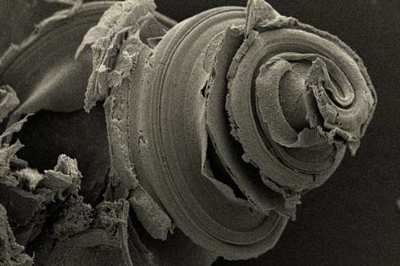 A cochlea under a high-resolution electron microscope. 
