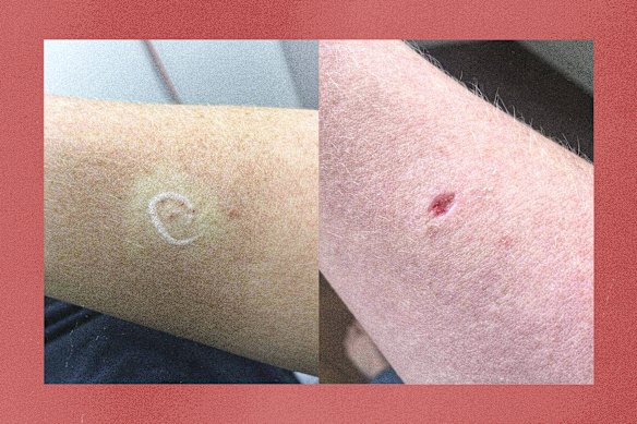 Non-melanoma treatments emerge amid concerns about solar power complacency