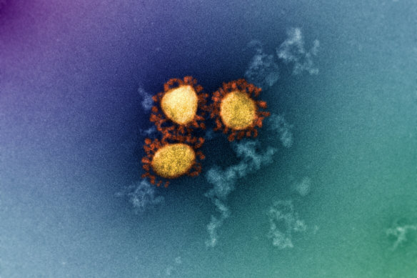 Omicron negative stain images created at the Doherty Institute.                  