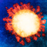 An electron microscope image of the SARS-CoV-2 omicron variant of the coronavirus.  