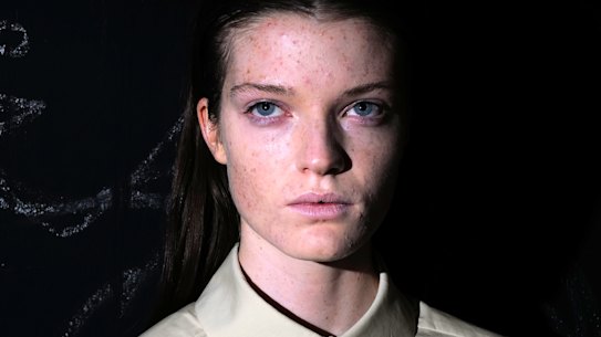 A model backstage at the Gauchere spring 202 ready to wear show. Studies show that acne is a concern for 85 per cent of 12-25 year olds.
