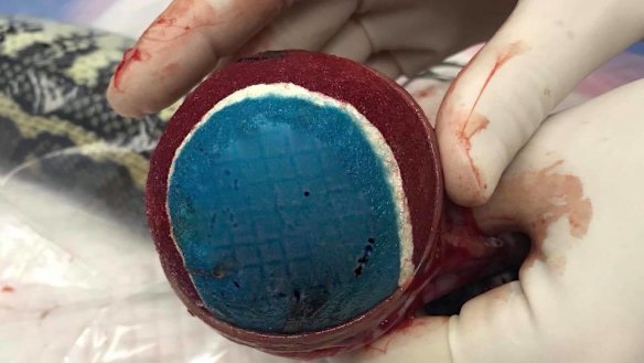 The tennis ball was removed from the python's stomach in a 40 minute surgery procedure.