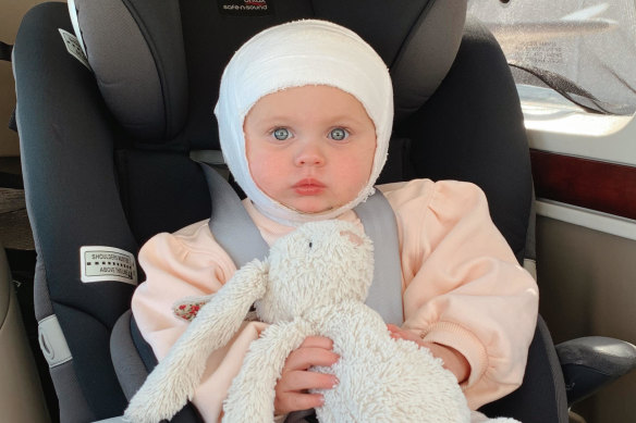 Victoria Vaclavik before her operation after accidently topling a cup of tea onto herself.