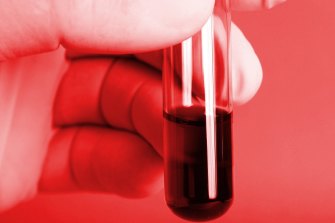 CSL joins forces with competitor to take on US Customs and Border Protection