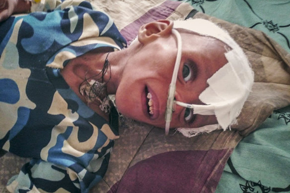 In this photo provided anonymously, a severely malnourished child is treated in an intensive care unit at the Ayder Referral Hospital, where medicines have almost run out and hospital staffers haven’t been paid since June, in Mekele, in the Tigray region of northern Ethiopia in Sept. 