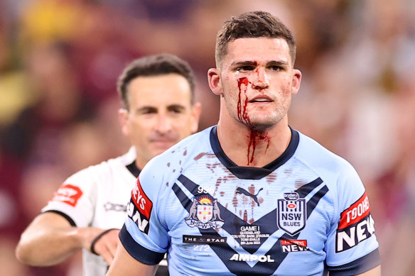 Nathan Cleary has picked up a nasty cut.