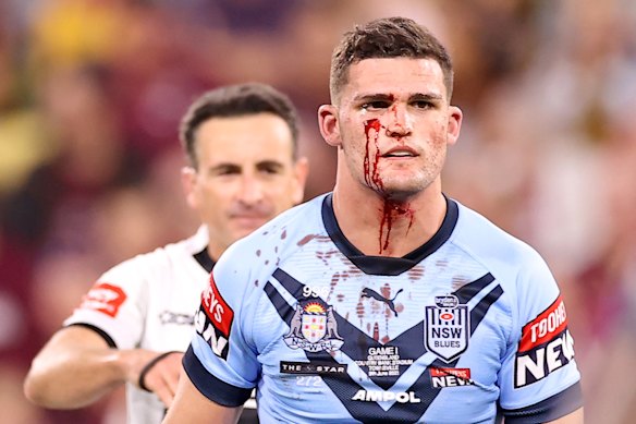 Nathan Cleary has picked up a nasty cut.