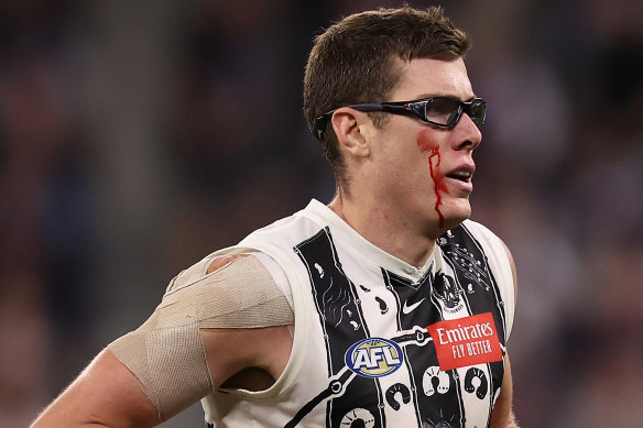 Mason Cox of the Magpies comes from the field under the blood rule.