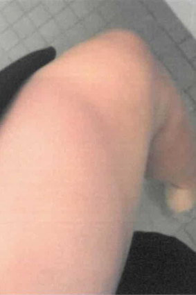 A photo tendered in court in Bruce Lehrmann’s defamation trial of what Brittany Higgins described as a bruise on her leg.