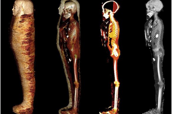 The layers of an Egyptian mummy dating to 330 BC are pictured using CT (computed tomography). A group of scientists from Cairo University have revealed previously unknown details about the mummified teenage boy.