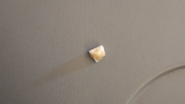 Melbourne man Bradley Button chomped down on what he believes was a chipped tooth - that wasn't his - on a Wellington to Melbourne, Singapore Airlines flight.