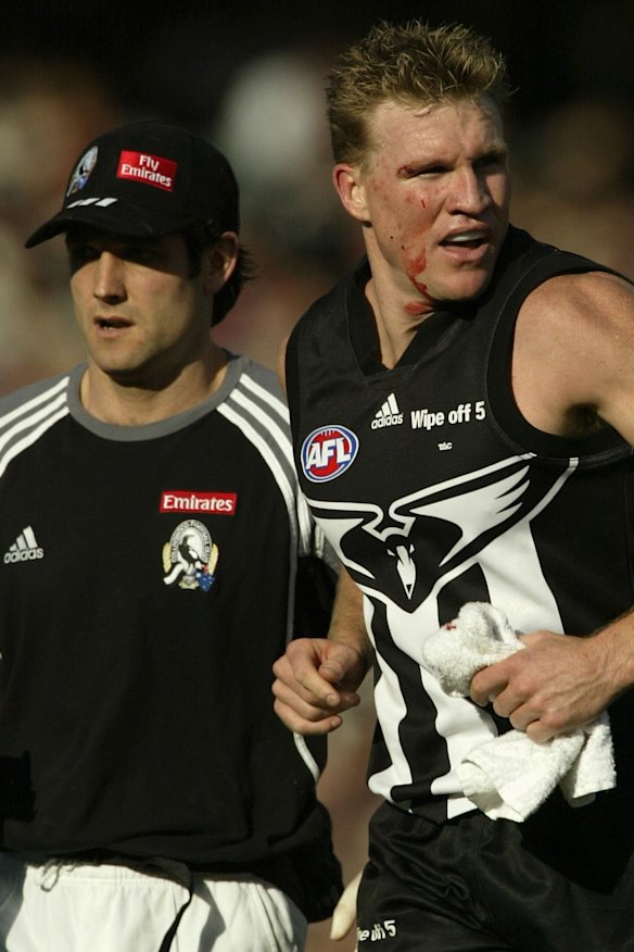Nathan Buckley leaves the field bleeding in 2002.