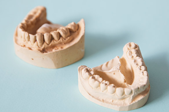 How your teeth can show if you’re stressed