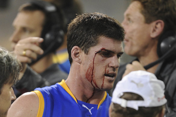 Jonathan Brown comes off the field under the blood rule in 2009. 