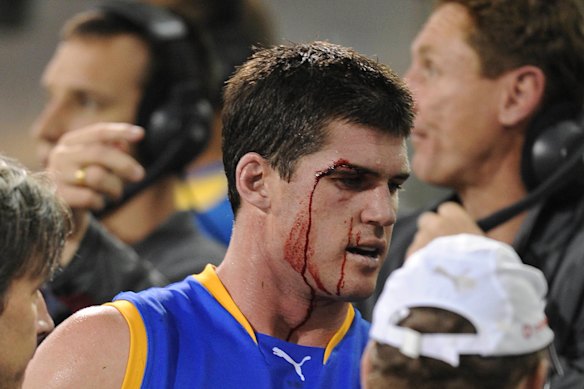 Jonathan Brown comes off the field under the blood rule in 2009. 