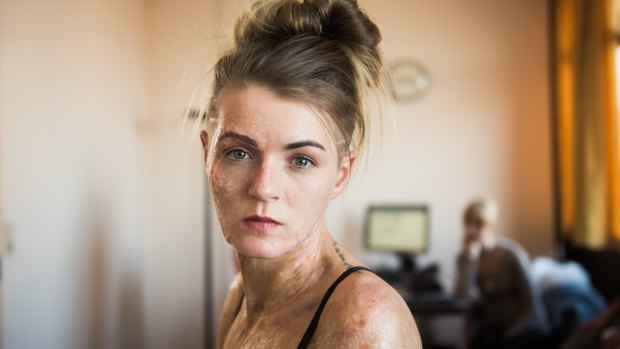 Vicky Knight bares her real-life scars in Dirty God.