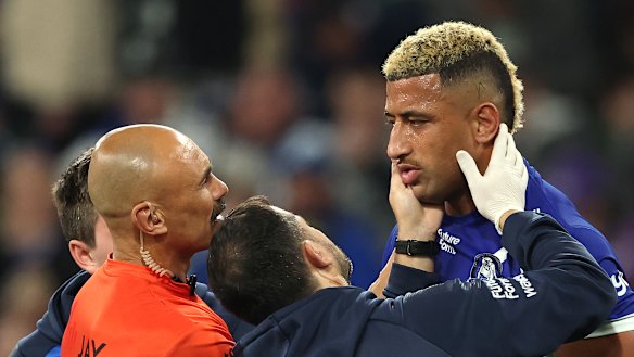 Viliame Kikau has refused to undergo scans for a potential facial fracture.