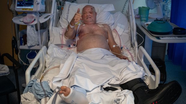 Traffic controller Michael De Vos said he hadn’t suffered a single broken bone before he was hit by a car on Kelvin Grove Road.