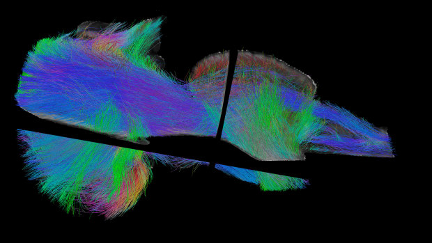 All the pathways of the brainstem traced via tractography and MRI.
