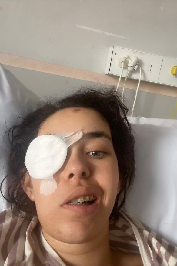 Jade suffered an ulcer on her eye after her meningioma was removed.