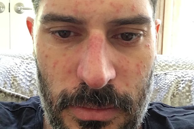 Joe Manganiello health battle