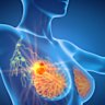 Optiscan Imaging has inked a collaborative deal with US-based Long Grove Pharmaceuticals to trial the drugmaker’s AK-FLUOR fluorescein dye in Optiscan’s imaging technology, initially to detect breast cancer.