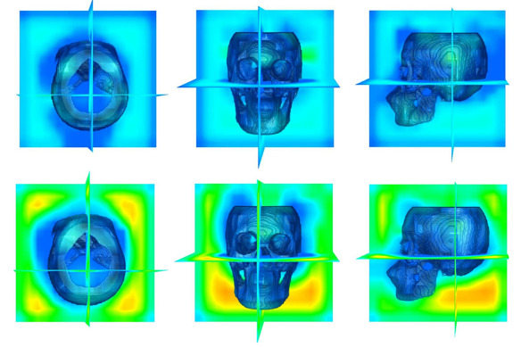 AI took a different route to human assessors when analysing skull structures.