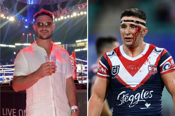 England and Roosters lock Victor Radley is being investigated after allegedly being involving involved in a fight in the United Kingdom during the World Cup.