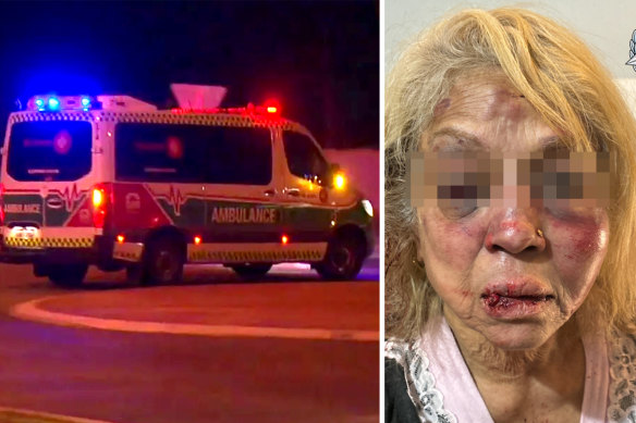 A 73-year-old woman was seriously injured in the robbery. Police released an un-edited picture of the woman to convey to the public the violent and unprovoked nature of the attack 