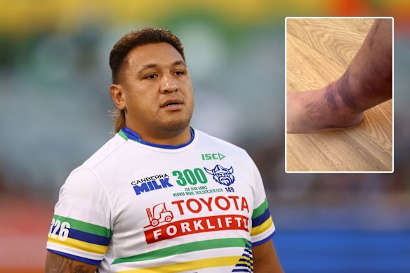 Josh Papalii is hoping to be fit enough for week one of the finals after injury his ankle.
