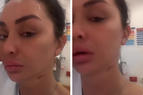Jenny Elhassan posted on TikTok from the hospital after the alleged acid attack.