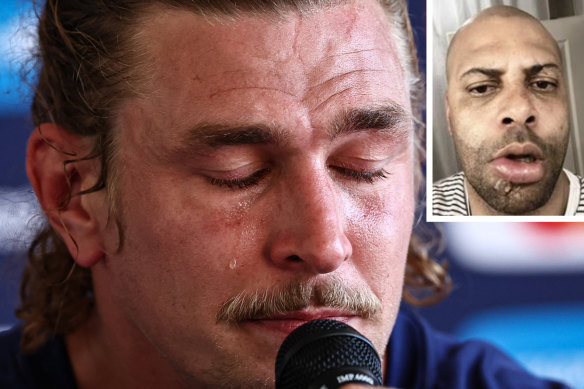 Bastien Chalureau cries as he talks to journalists during a press conference. Inset: Yannick Larguet’s facial injuries after being attacked by the French second-rower in 2020.