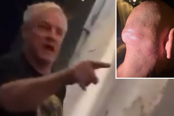 Paul Kent, left, gesticulates during the alleged affray, and, inset, the bump left on Uzun’s head