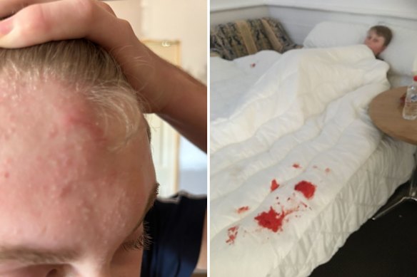Jack in state-funded accommodation after allegedly being physically assaulted by a carer.