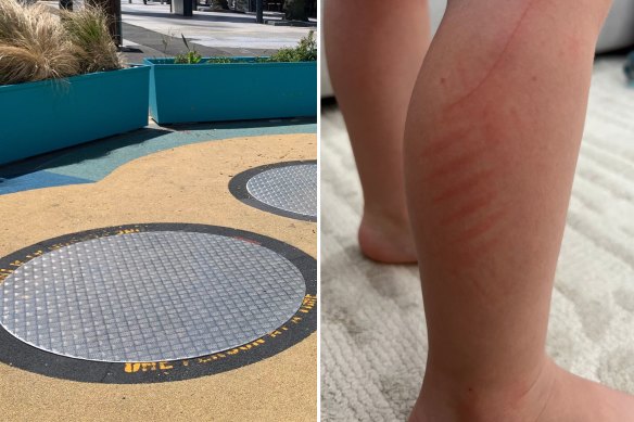 Metal plates (left) installed over the top of the trampolines, and (right) the burn suffered by Ashleigh Markou’s daughter.