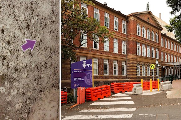 Mould uncovered at Sydney’s RPA Hospital.
