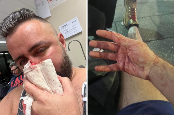Adrian Lea believes he was the victim of a homophobic bashing. 