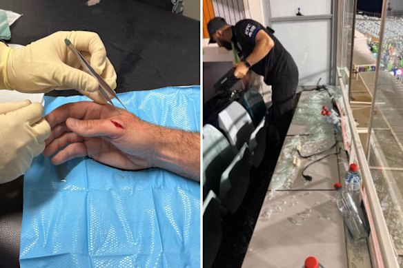 Bulldogs coach Cameron Ciraldo has his hand stitched up after the Canberra Stadium window shattered in his coach’s box.