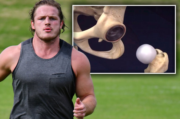 George Burgess will spend time against Parramatta on Sunday week after undergoing hip resurfacing surgery.