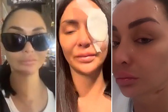 Sydney TikTok personality Jenny Elhassan was the victim of an alleged acid attack on Friday night. 