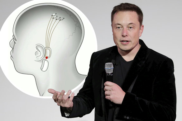 Elon Musk is making big promises about his medical start-up.